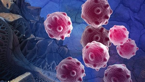 瑞典科学家开发新方法：可帮助助免疫系统根除脑肿瘤