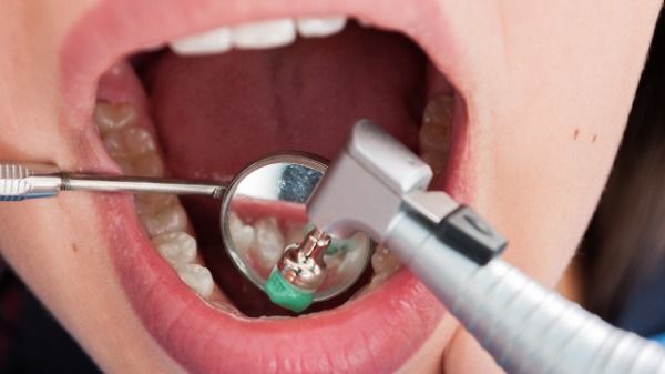 24岁男子3颗烂牙没治感染大脑 烂牙不治的危害有多大
