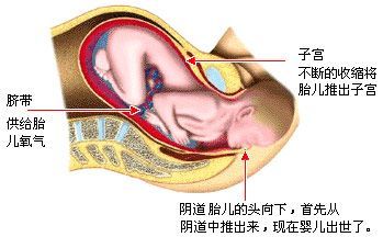 第二产程(胎儿娩出期)