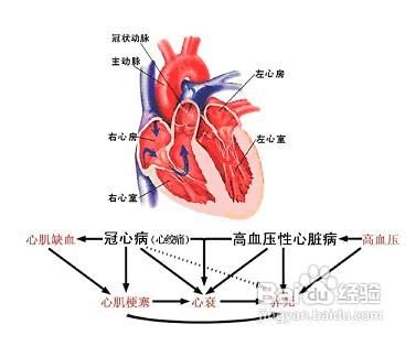 心脏病患者不得不说的那些饮食禁忌