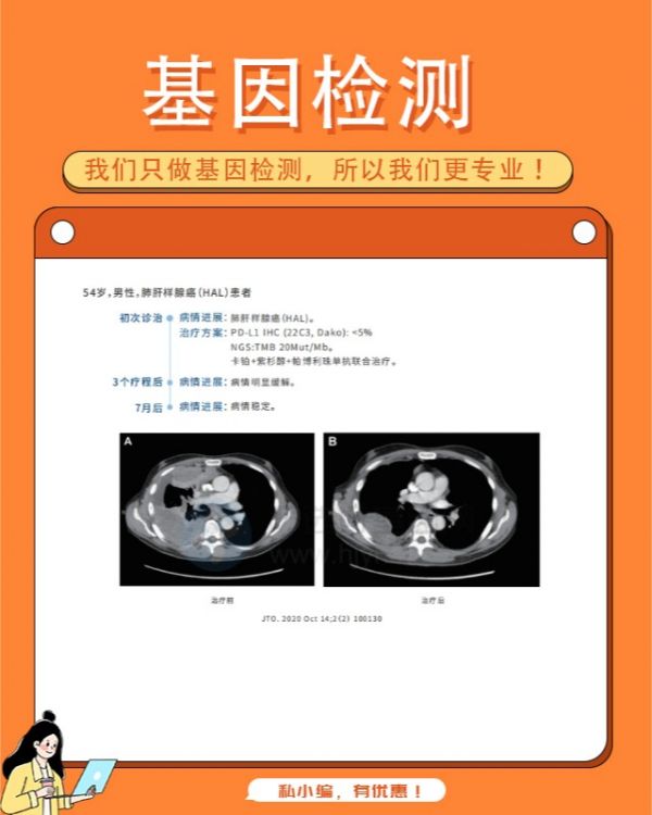 通俗易懂解析基因检测全貌