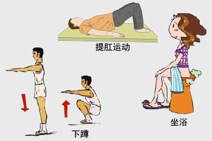 性功能锻炼3种方法图