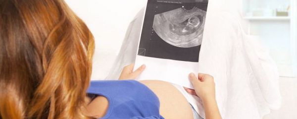 孕期水肿吃什么好 孕妇吃什么去湿 孕妇吃什么消除水肿