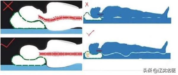 眩晕千万种，辨证施治很重要