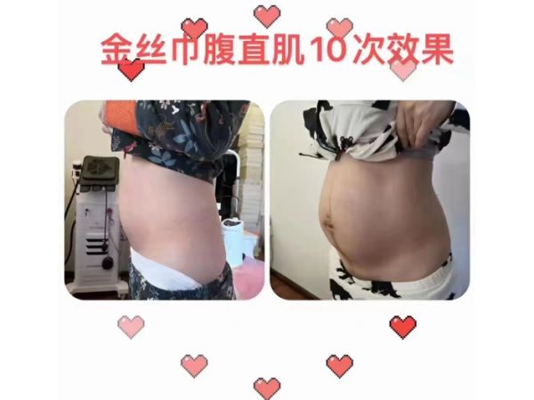 贵州产后身材恢复有去试过的吗,复