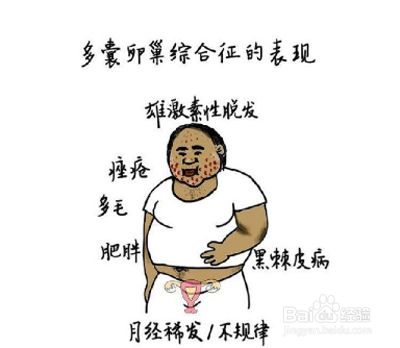 女性雄激素过高怎么调理