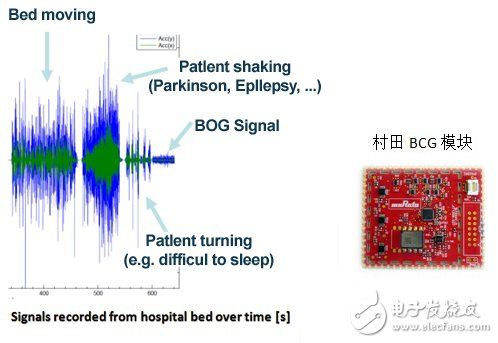 村田智能BCG方案，打造主动健康监测