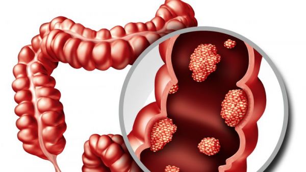 直肠的具体位置