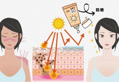 防曬成分二苯酮-3的功效及作用插圖