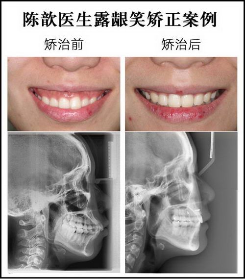 陈歆医生｜改变人生的正畸“疑难杂症解决专家”