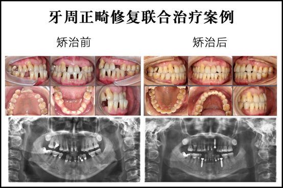 陈歆医生｜改变人生的正畸“疑难杂症解决专家”