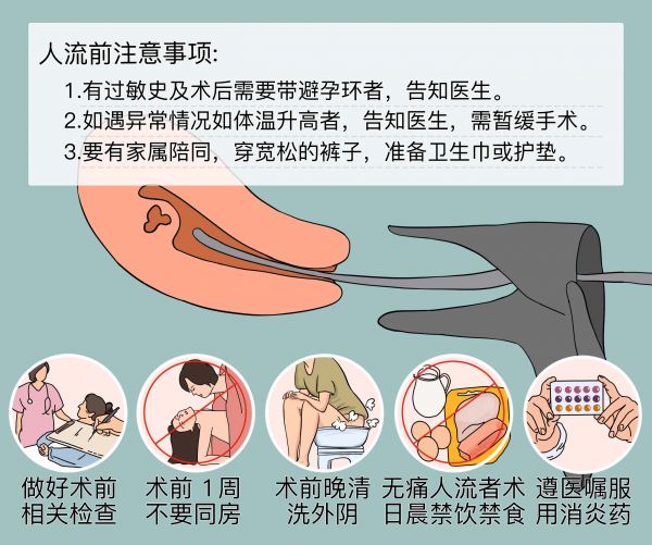 做人流前要準(zhǔn)備什么和注意什么.jpg