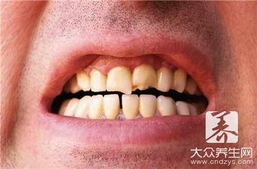 牙齒往里凹怎么辦呢
