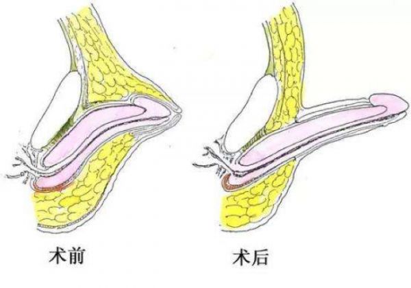 春雨醫(yī)生