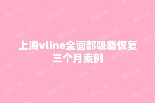 上海vline全面部吸脂恢复三个月案例