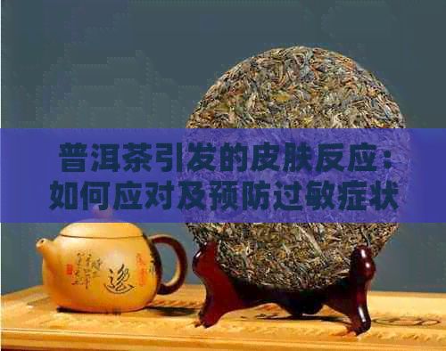 普洱茶引发的皮肤反应：如何应对及预防过敏症状