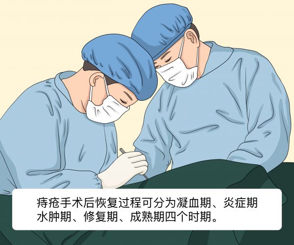 痔瘡手術(shù)后的恢復過程詳細.jpg