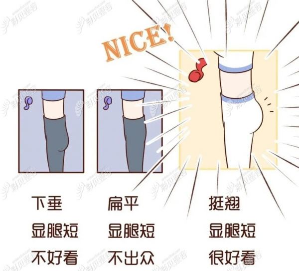 我的臀部吸脂对比图