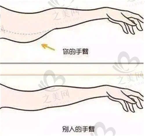 銀川麗都醫(yī)療美容醫(yī)院手臂吸脂價格范圍
