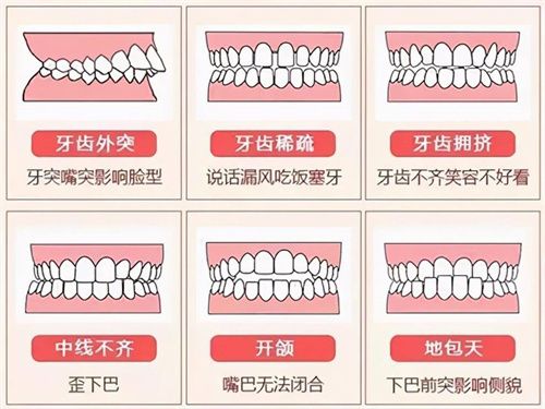 DamonQ和DamonQ2的区别详解：DamonQ2矫正更有效、更快、更舒适