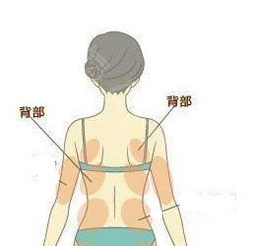 背部脂肪特征及分布特點，如何選擇吸脂手術(shù)好？