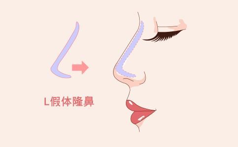 背部吸脂多少錢(qián) 背部吸脂價(jià)格是多少 背部吸脂的步驟是什么