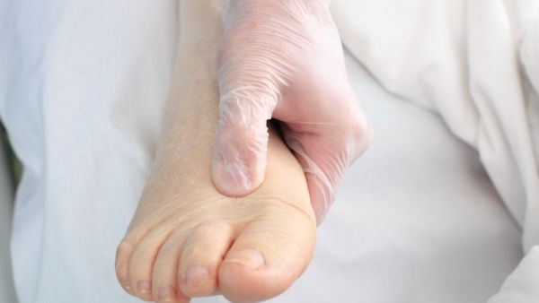 水腫體質(zhì)怎么快速消水腫