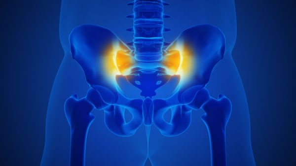 骶髂关节疼 Sacroiliac joint pain