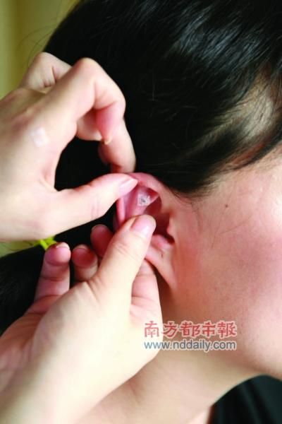 一開春就減肥，搓揉扎三部曲換代啦！