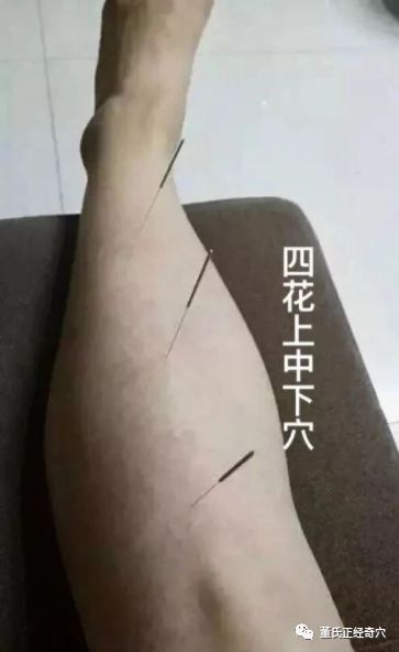 https://img.miyanlife.com/mnt/timg/181114/113TL441-4.jpg