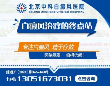 北京中科白癜风医院