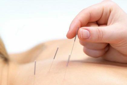 做针灸减肥哪几个穴最重要