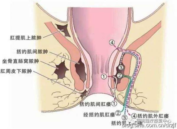 有一种特别摄生办法，它在肛门调度，叫做>（图六）