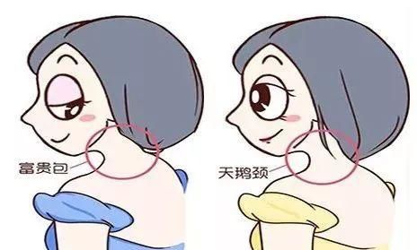 富贵包=夺命包、富贵包的十五大危害