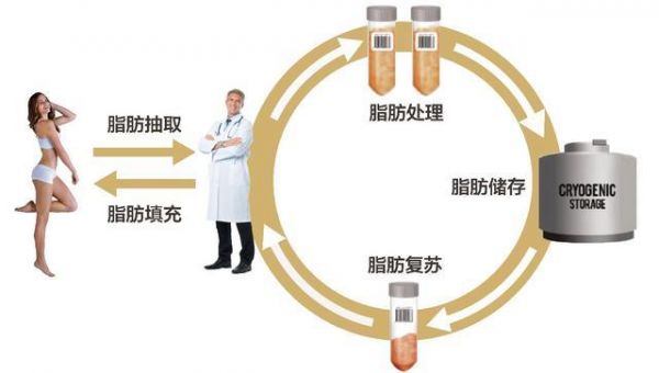 颜值经济 存脂肪似储软黄金