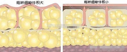 脂肪細(xì)胞大小的區(qū)別