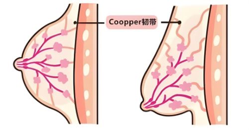 乳房下垂韌帶組織對(duì)比
