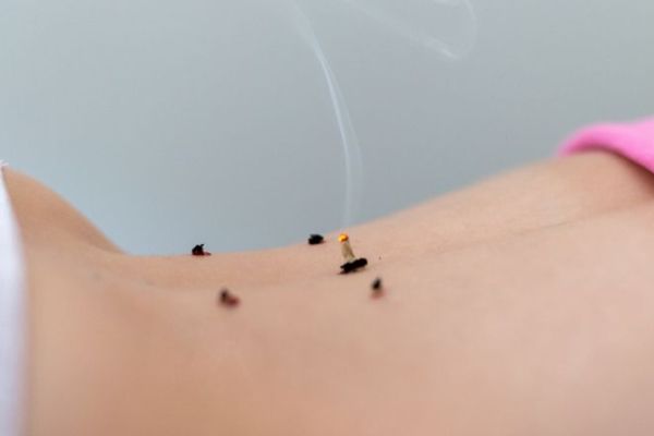 艾灸減肥方法圖解 艾灸減肥穴位 艾灸減肥的方法