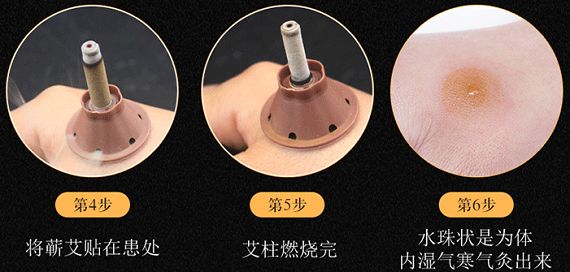 艾灸贴使用图解