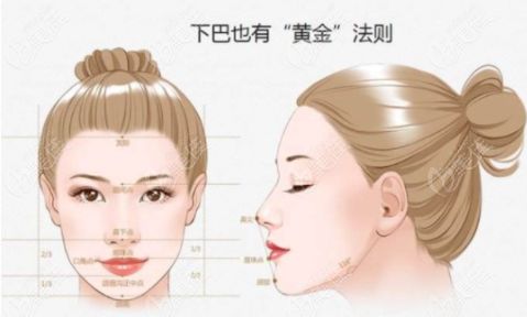 下巴整形手術(shù)有哪幾種呢？