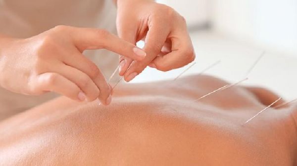 中醫(yī)薦：常見針灸減肥穴位