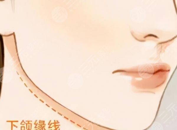 下顎線提升怎么做?
