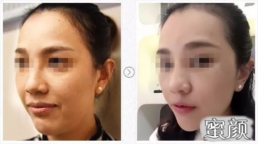 https://img.miyanlife.com/mnt/timg/200422/143HI133-6.jpg