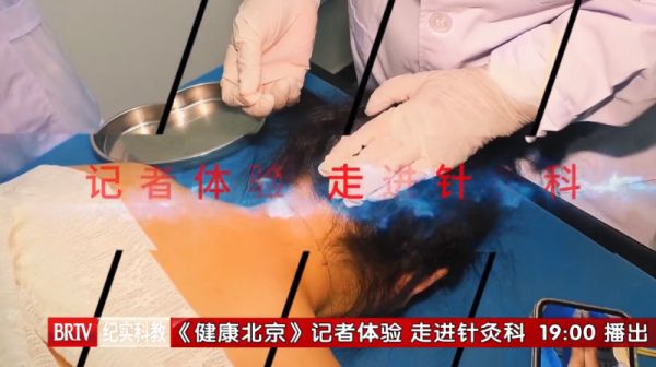 《健康北京》记者走进北京石景山八大处中西医结合医院探秘针灸科