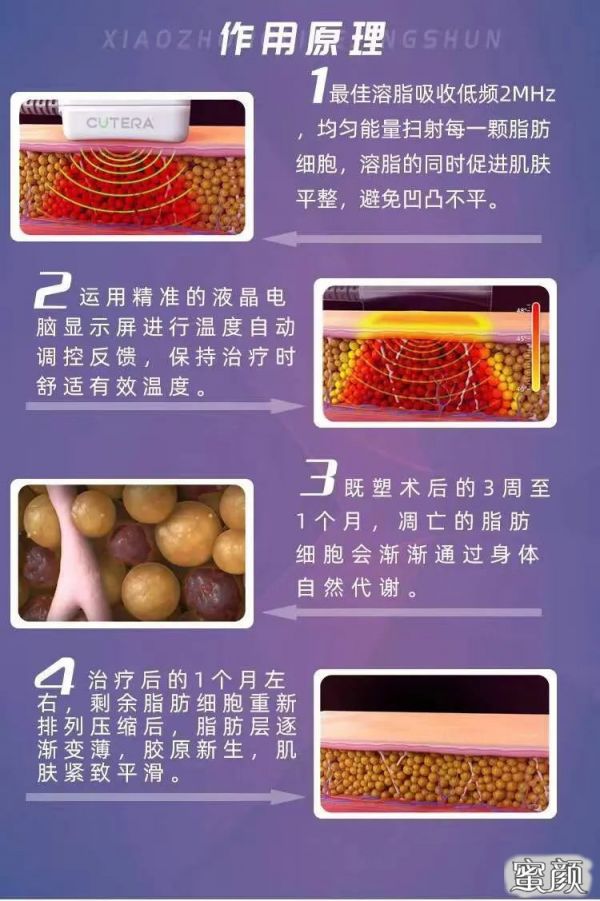 https://img.miyanlife.com/mnt/timg/210127/1113036411-2.jpg