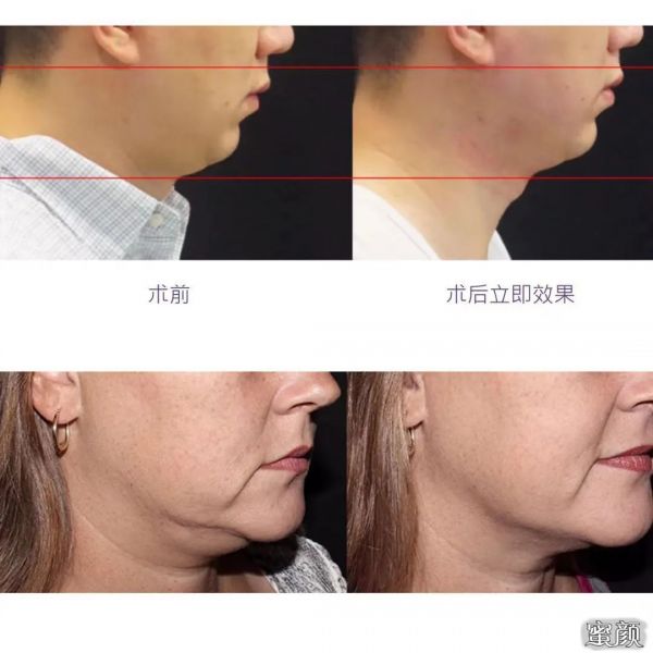 https://img.miyanlife.com/mnt/timg/210127/1113154Q2-8.jpg