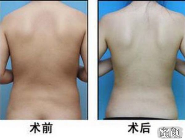 https://img.miyanlife.com/mnt/Editor/2023-03-21/6419cae8636a6.jpg