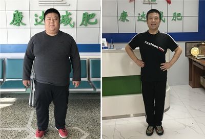 劉小冬在長(zhǎng)春康達(dá)減肥醫(yī)院瘦179斤1