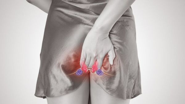 肛门水肿的治疗