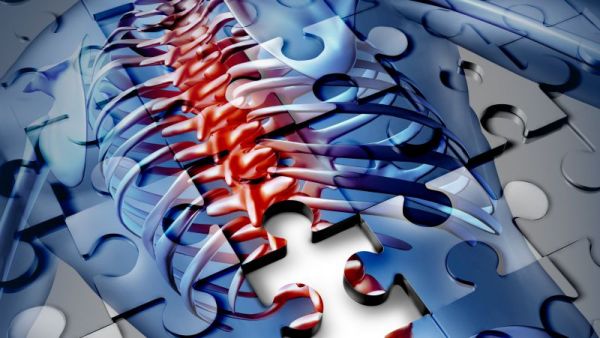 脊髓水肿治疗方法有哪些